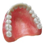 denture3