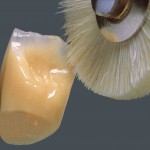 denture_vm-paint1