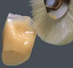 denture_vm-paint1_1
