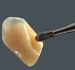 denture_vm-paint2