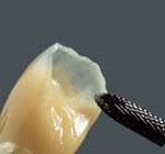 denture_vm-paint3