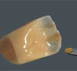 denture_vm-paint6
