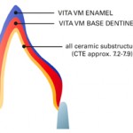 vm2layer