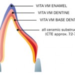 vm3layer