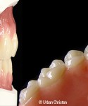 PremiumTeeth_dentures_960x300