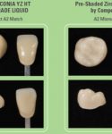 Zirconia Shade Comparison