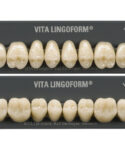 teeth2